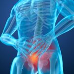 Memahami Nyeri Prostat yang Kuat dan Cara Menyikapinya Secara Bijak